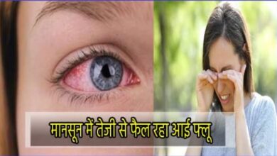 मानसून काल में तेजी से फैल रहा आई फ्लू संक्रमण, जिला अस्पताल में रोजाना देखे जा रहे 30 से 40 मामले 