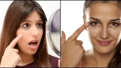 आँखों के नीचे काले घेरों से हैं परेशान ? जानिए कौन से पोषक तत्व करेंगे मदद