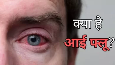 आई फ्लू क्या है ? जानिए मानसून में इससे बचाव के 5 तरीके