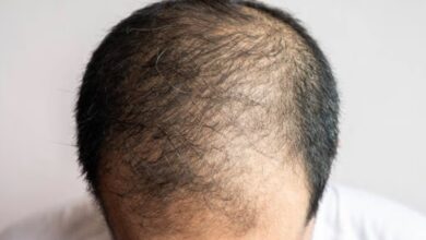 क्या सच में हेलमेट पहनने से झड़ते हैं बाल ? जानिए हकीकत