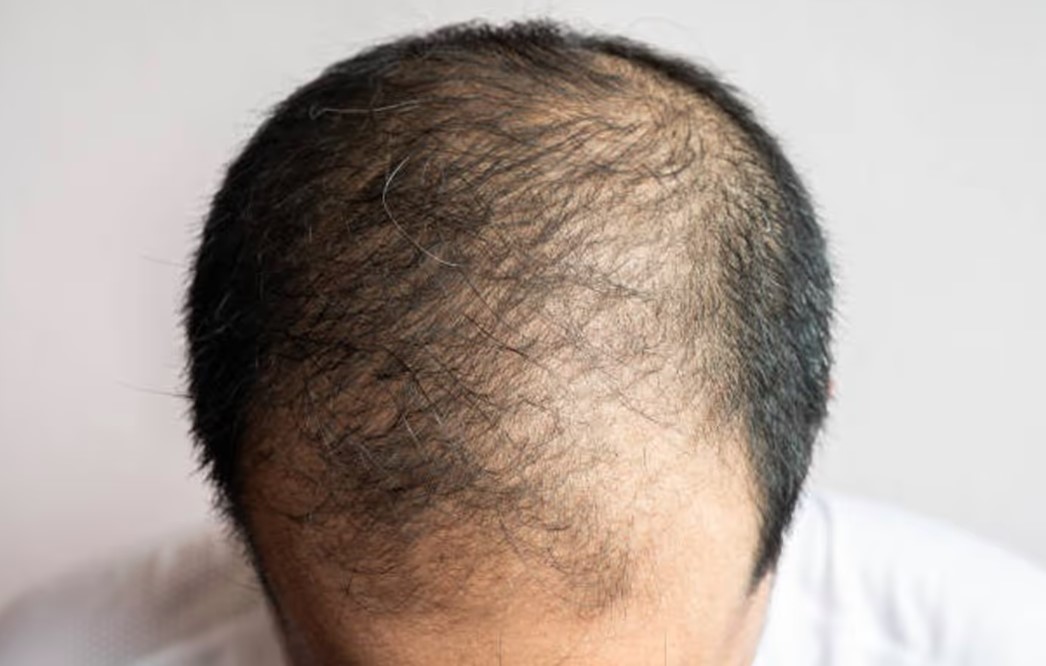 क्या सच में हेलमेट पहनने से झड़ते हैं बाल ? जानिए हकीकत