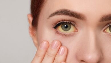 क्या है पीलिया और यह कैसे विकसित होता है ? आइये जानते हैं इसके लक्षण और कारण