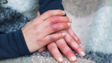 सर्दियों में क्यों होती है हाथ-पैर पर सूजन और जलन की समस्या? आइये जानते हैं इसके कारण