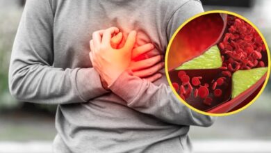 हाई कोलेस्ट्रॉल से बढ़ता है दिल की बीमारी का खतरा, जानिए कैसे करें बिना दवा के कंट्रोल