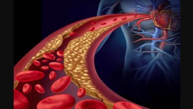 हाई कोलेस्ट्रॉल बन रहा युवाओं की बड़ी परेशानी, किचन की ये गलतियां बढ़ा रही हैं खतरा