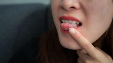 तीन हफ्ते से नहीं भर रहा मुंह का घाव? हो सकता है ओरल कैंसर का संकेत