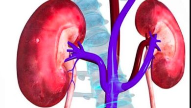 बदलती जीवनशैली और अनियमित खान-पान से बढ़ रहा किडनी रोग का खतरा, डॉक्टरों ने दी चेतावनी