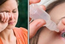 आंखों में जलन-खुजली से परेशान हैं? जानिए कारण और बचाव के उपाय