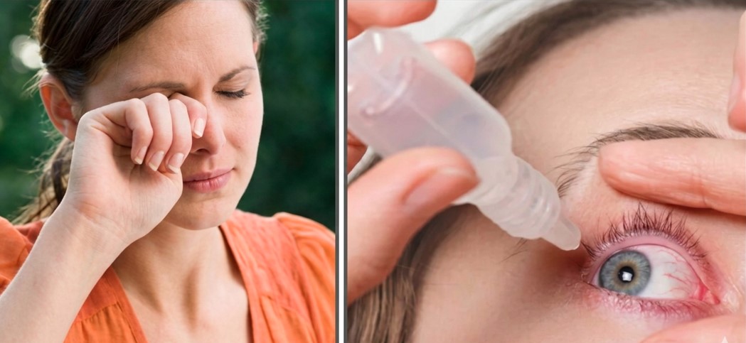 आंखों में जलन-खुजली से परेशान हैं? जानिए कारण और बचाव के उपाय